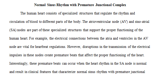 Normal Sinus Rhythm