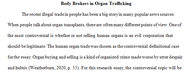 human organ trade